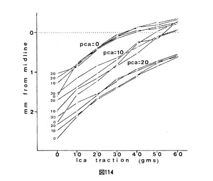 fig114