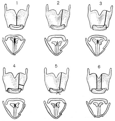 fig115