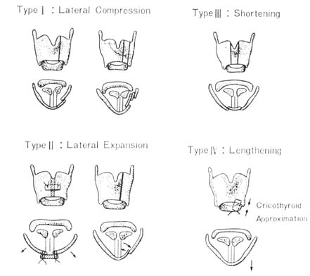 fig116