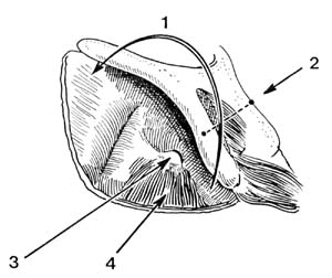 fig141