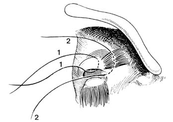 fig148