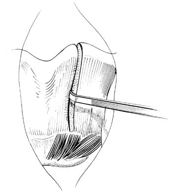 fig170