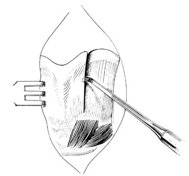 fig171