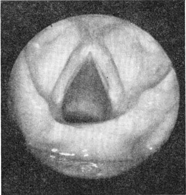 fig174