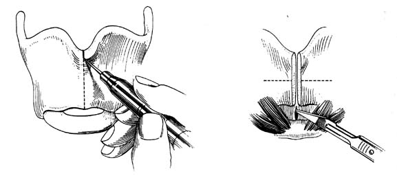 fig180