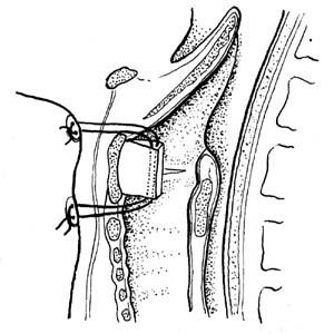 fig181