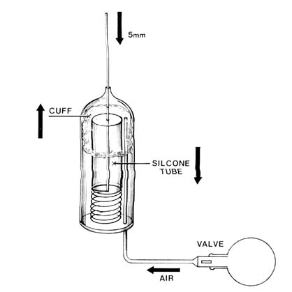 fig183