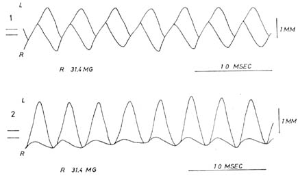 fig45