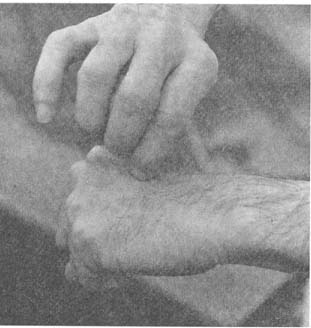 fig52
